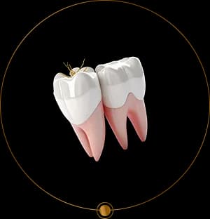 Reprezentare pentru chirurgie dentară