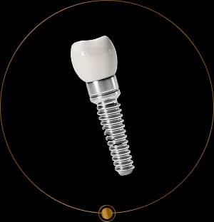 Implant dentar