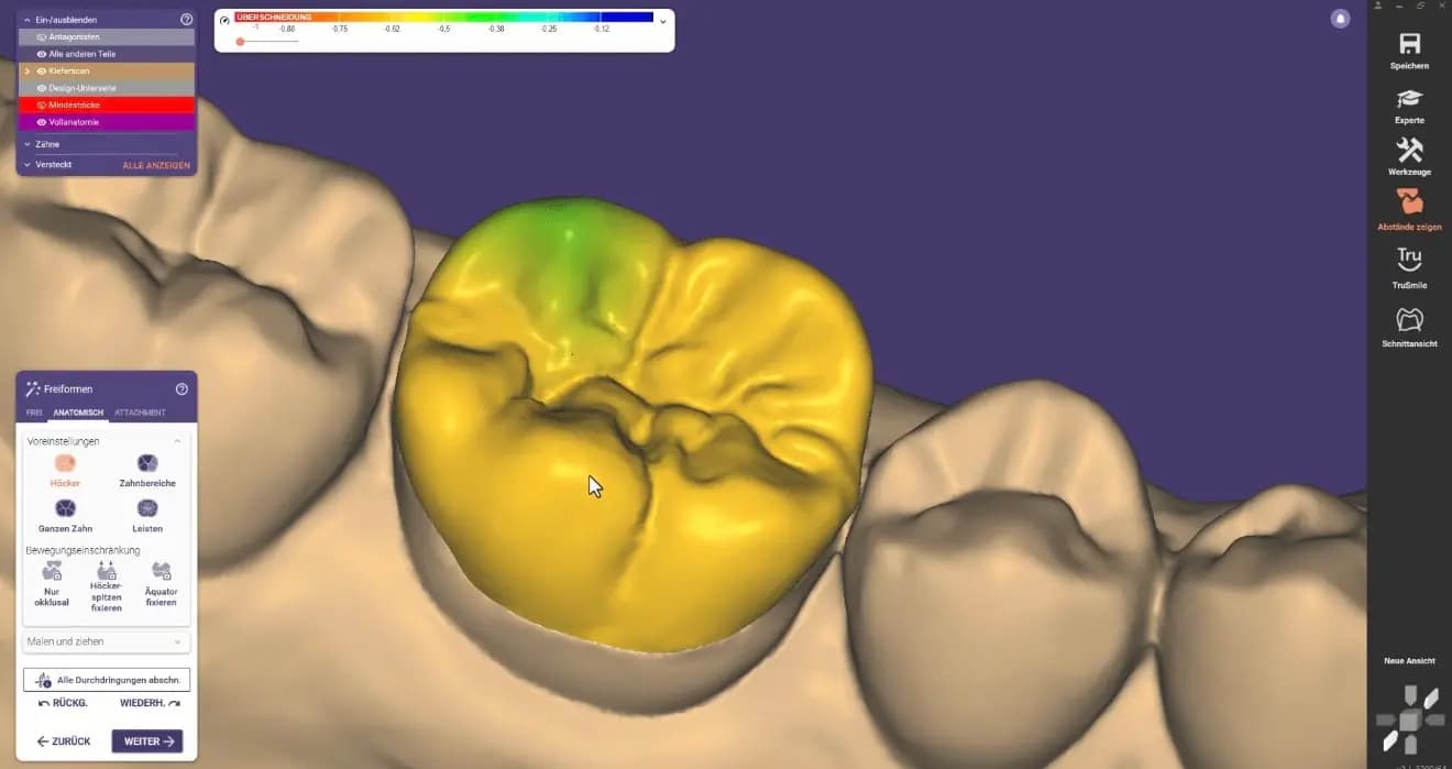 Tehnologie dentară digitală CAD/CAM